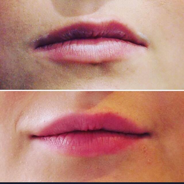 Defyne Aesthetics Skin & Laser Clinic - Defyne Aesthetics Skin & Laser Clinic