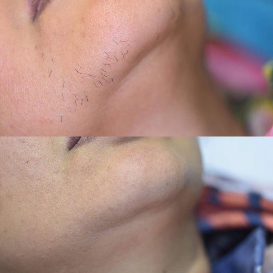 Defyne Aesthetics Skin & Laser Clinic - Defyne Aesthetics Skin & Laser Clinic