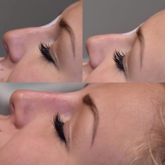 Defyne Aesthetics Skin & Laser Clinic - Defyne Aesthetics Skin & Laser Clinic