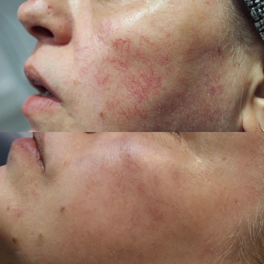 Defyne Aesthetics Skin & Laser Clinic - Defyne Aesthetics Skin & Laser Clinic