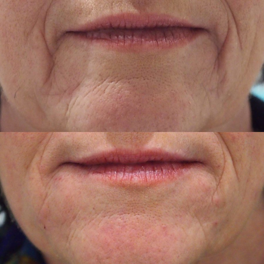 Defyne Aesthetics Skin & Laser Clinic - Defyne Aesthetics Skin & Laser Clinic