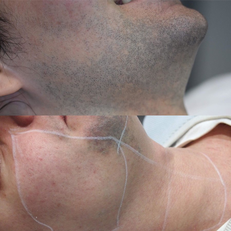 Defyne Aesthetics Skin & Laser Clinic - Defyne Aesthetics Skin & Laser Clinic