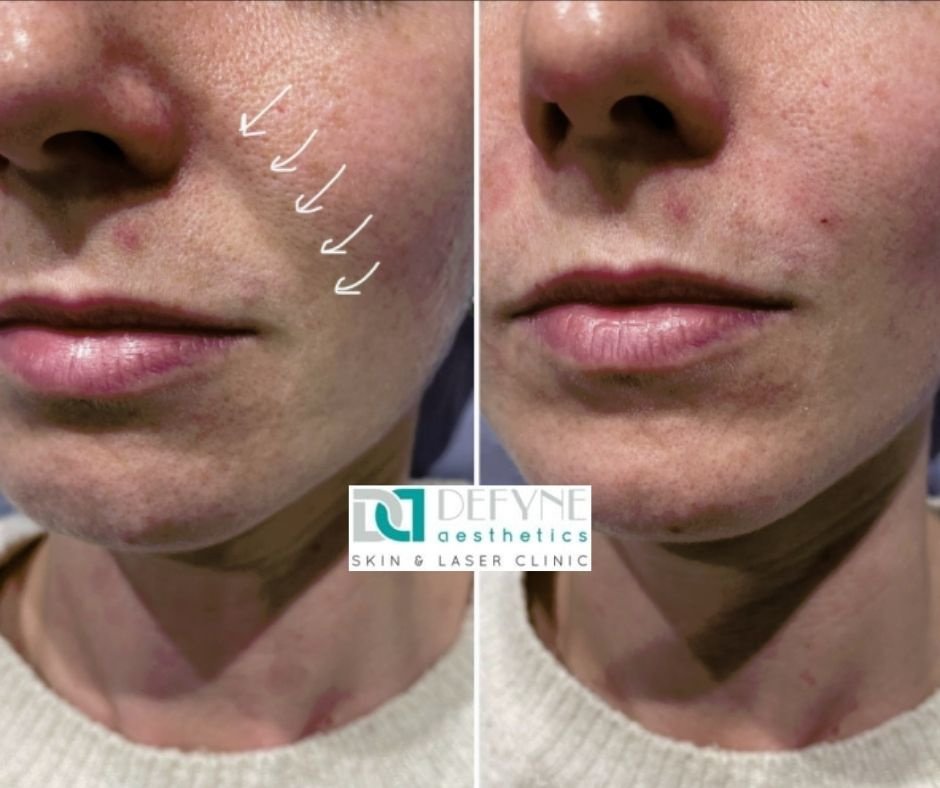 Defyne Aesthetics Skin & Laser Clinic - Defyne Aesthetics Skin & Laser Clinic