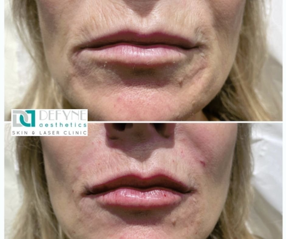 Defyne Aesthetics Skin & Laser Clinic - Defyne Aesthetics Skin & Laser Clinic