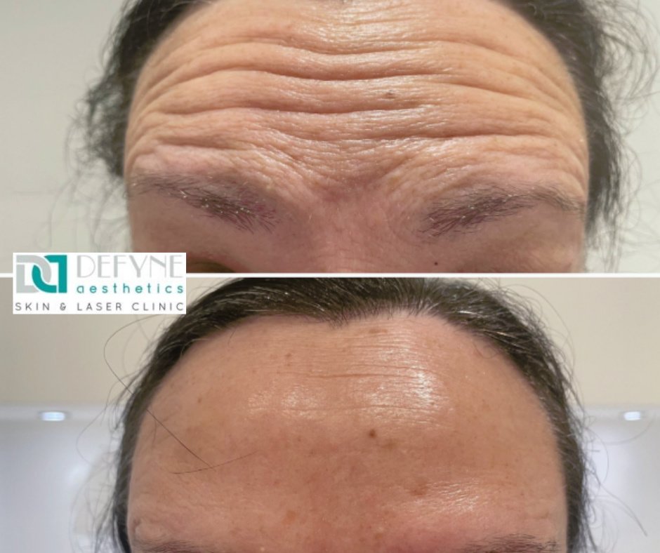 Defyne Aesthetics Skin & Laser Clinic - Defyne Aesthetics Skin & Laser Clinic