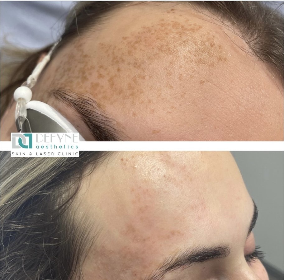 Defyne Aesthetics Skin & Laser Clinic - Defyne Aesthetics Skin & Laser Clinic