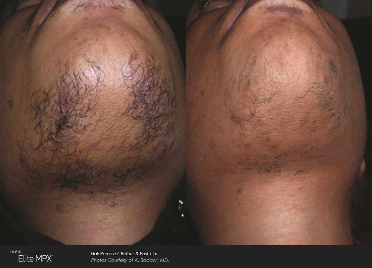 Defyne Aesthetics Skin & Laser Clinic - Defyne Aesthetics Skin & Laser Clinic