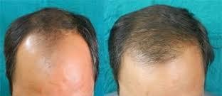 عيادة دلهي للشعر - أحمد أباد - Delhi Hair Clinic - Ahmedabad