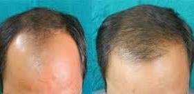 عيادة دلهي للشعر - أحمد أباد - Delhi Hair Clinic - Ahmedabad