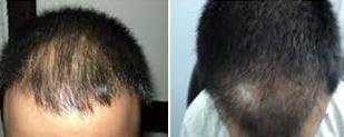 Delhi Hair Clinic - Jalandhar - Delhi Hair Clinic - Jalandhar