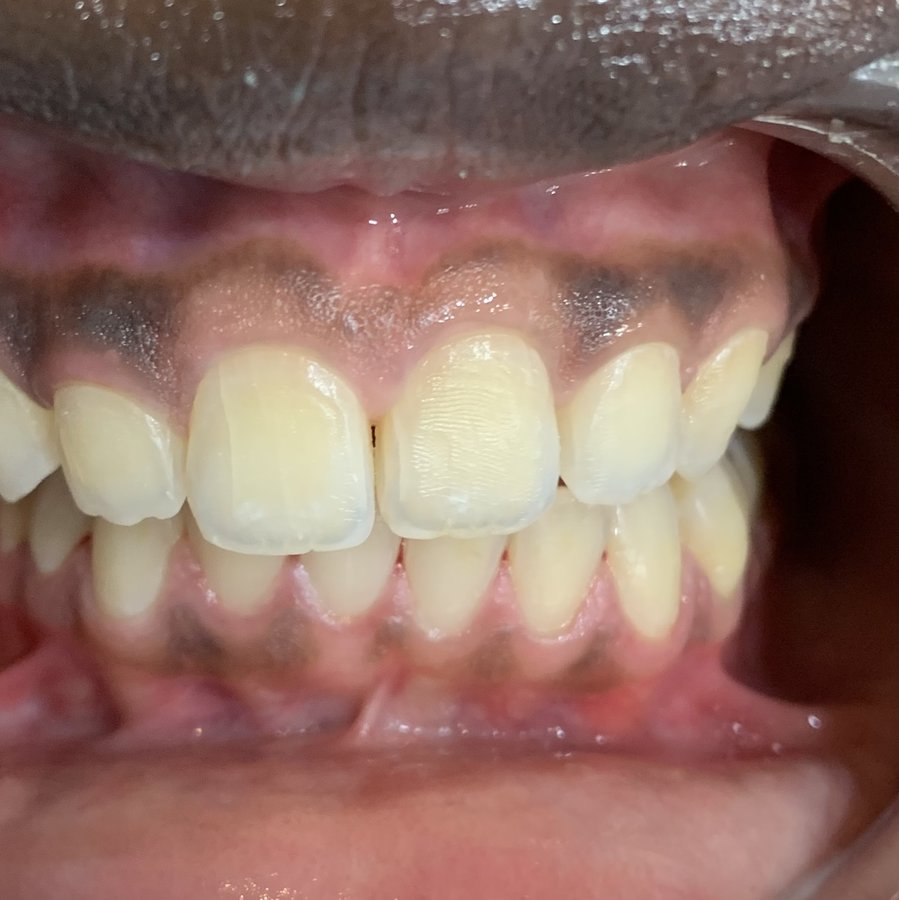 Denstetica - Denstetica