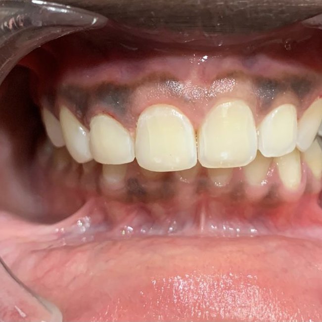 Denstetica - Denstetica