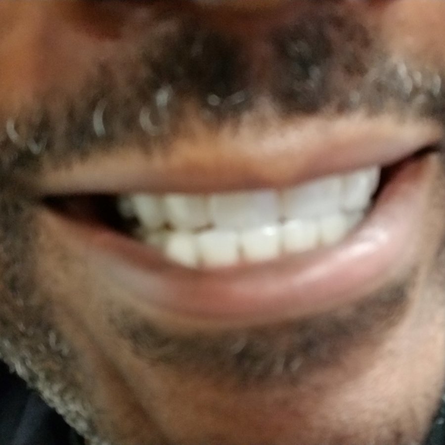 Denstetica - Denstetica