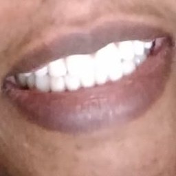 Denstetica - Denstetica