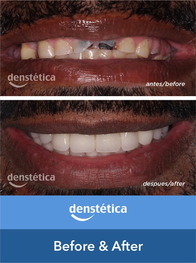 Denstetica - Denstetica