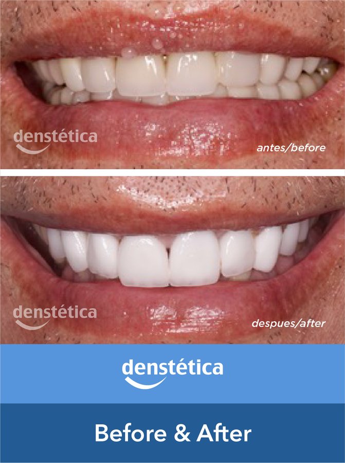 Denstetica - Denstetica