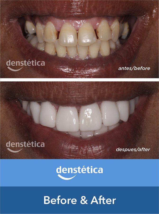 Denstetica - Denstetica