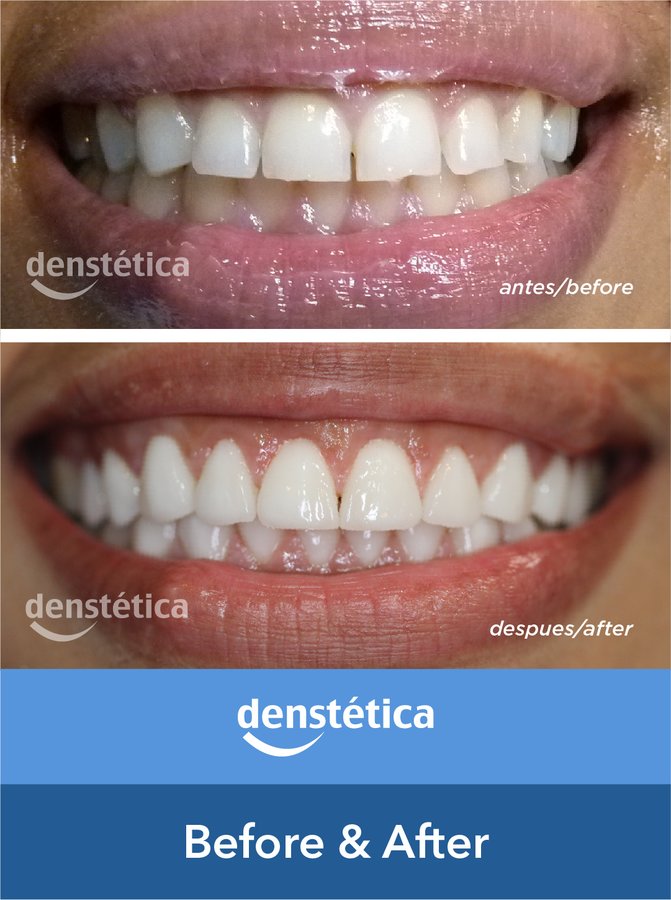 Denstetica - Denstetica