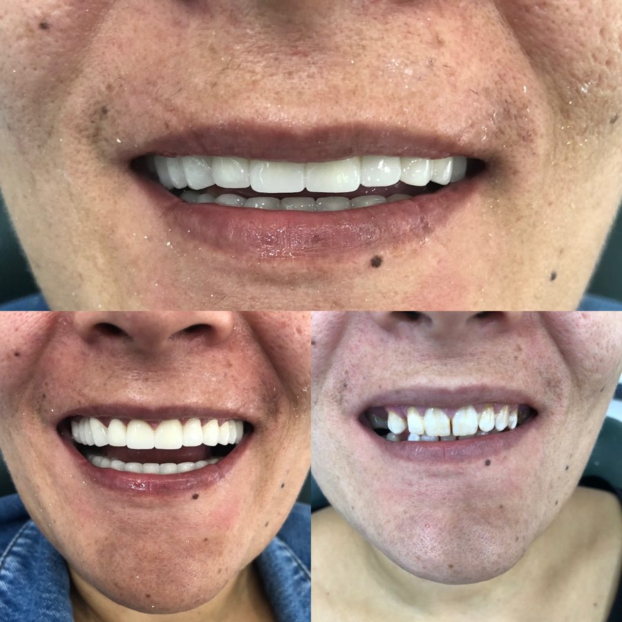 DENT 242 AĞIZ VE DİŞ SAĞLIĞI POLİKLİNİĞİ - DENT 242 AĞIZ VE DİŞ SAĞLIĞI POLİKLİNİĞİ