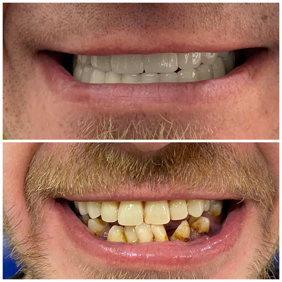 DENT 242 AĞIZ VE DİŞ SAĞLIĞI POLİKLİNİĞİ - DENT 242 AĞIZ VE DİŞ SAĞLIĞI POLİKLİNİĞİ