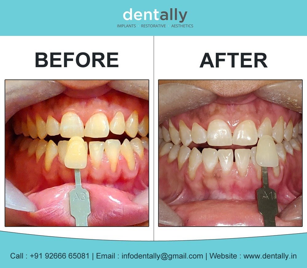 Dent Ally- Gurugram - Dent Ally- Gurugram