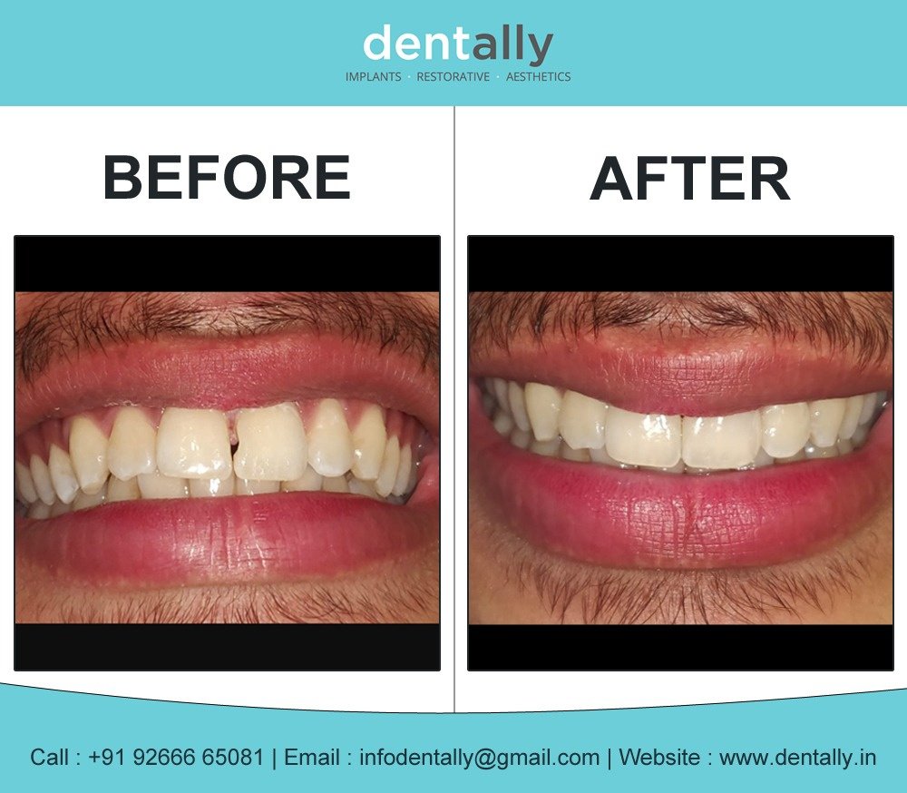 Dent Ally- Gurugram - Dent Ally- Gurugram