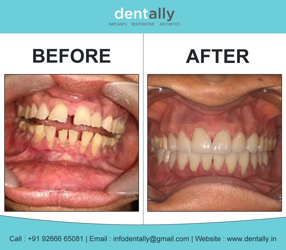 Dent Ally- Gurugram - Dent Ally- Gurugram