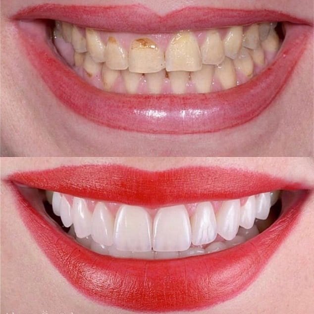 DENT ART PORT DİŞ KLİNİĞİ - DENT ART PORT DİŞ KLİNİĞİ