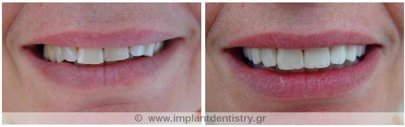 Dent Artistry Contemporary Prosthodontics - Dent Artistry Contemporary Prosthodontics