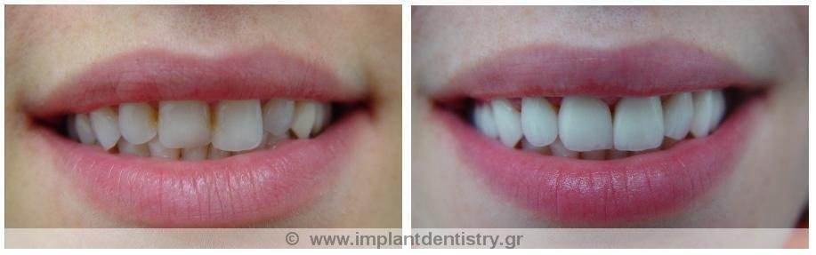 Dent Artistry Contemporary Prosthodontics - Dent Artistry Contemporary Prosthodontics