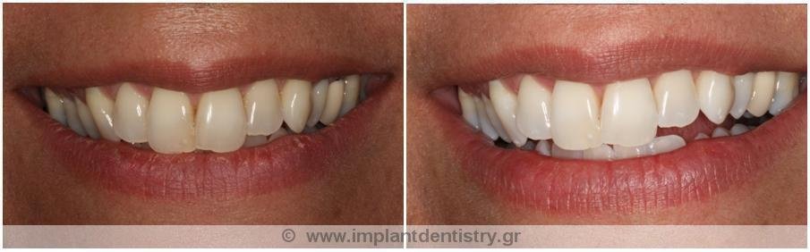 Dent Artistry Contemporary Prosthodontics - Dent Artistry Contemporary Prosthodontics
