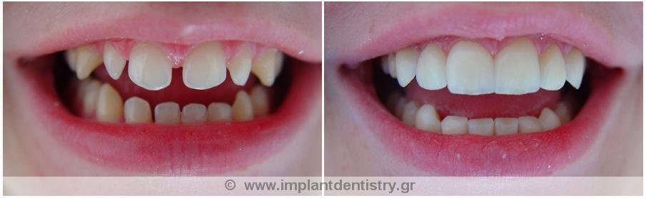 Dent Artistry Contemporary Prosthodontics - Dent Artistry Contemporary Prosthodontics