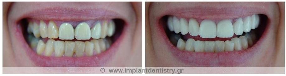 Dent Artistry Contemporary Prosthodontics - Dent Artistry Contemporary Prosthodontics
