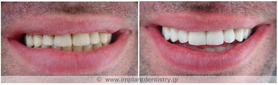 Dent Artistry Contemporary Prosthodontics - Dent Artistry Contemporary Prosthodontics