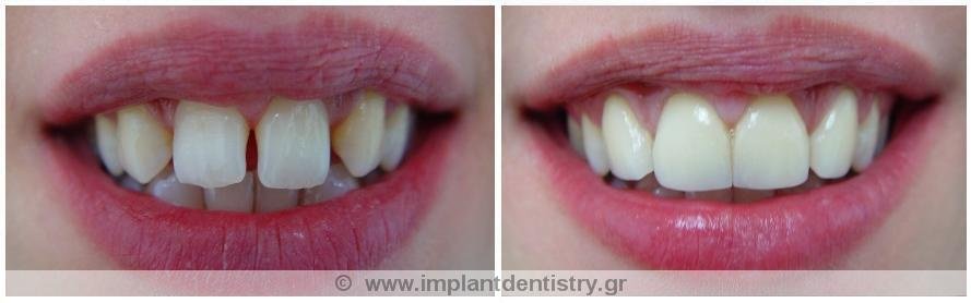 Dent Artistry Contemporary Prosthodontics - Dent Artistry Contemporary Prosthodontics