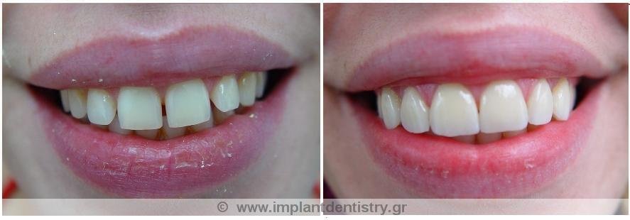 Dent Artistry Contemporary Prosthodontics - Dent Artistry Contemporary Prosthodontics