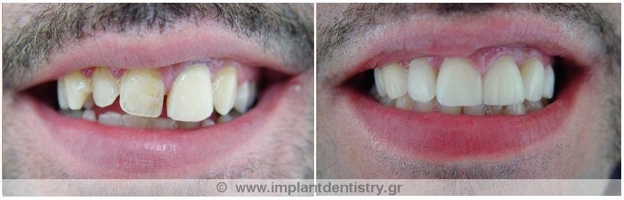 Dent Artistry Contemporary Prosthodontics - Dent Artistry Contemporary Prosthodontics