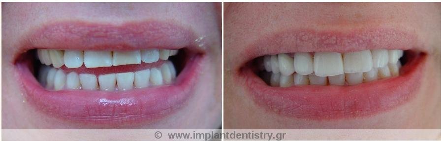 Dent Artistry Contemporary Prosthodontics - Dent Artistry Contemporary Prosthodontics