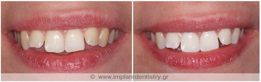 Dent Artistry Contemporary Prosthodontics - Dent Artistry Contemporary Prosthodontics