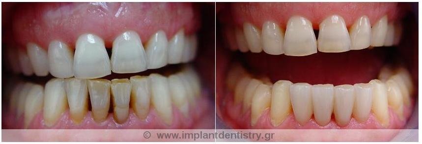 Dent Artistry Contemporary Prosthodontics - Dent Artistry Contemporary Prosthodontics
