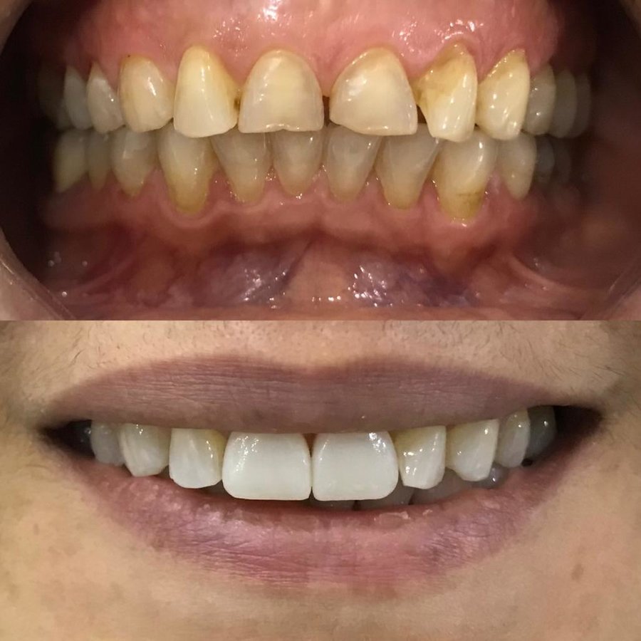 Dent Laracity - Dent Laracity