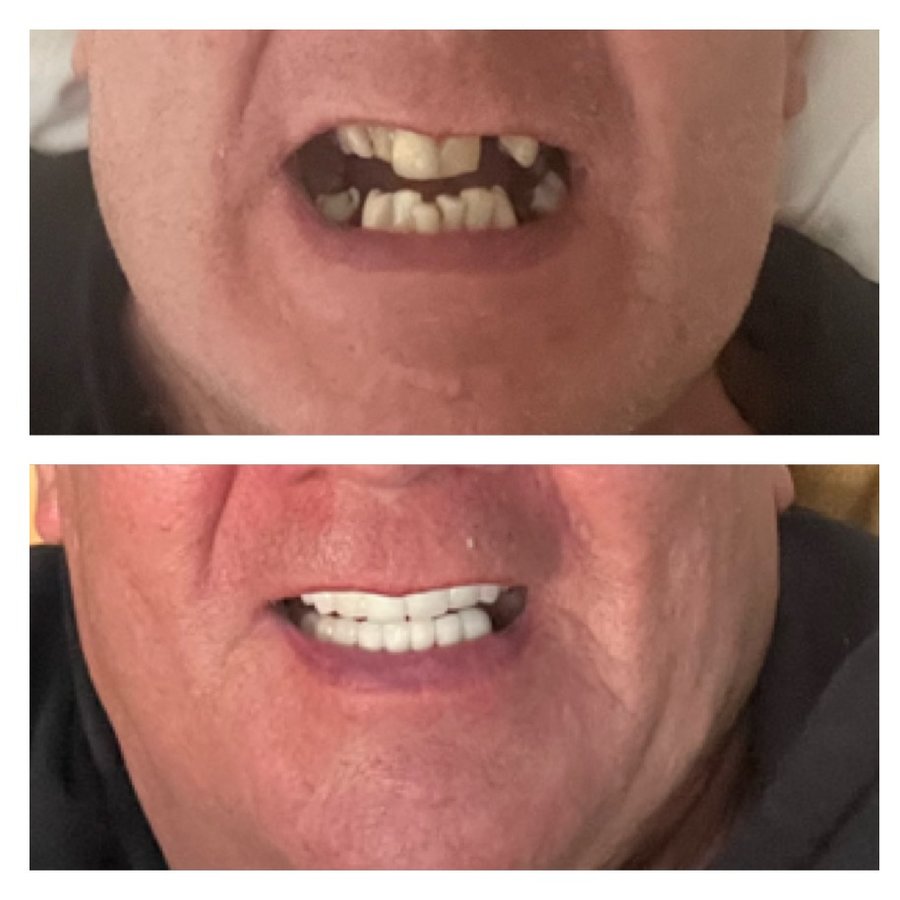 Dent Laracity - Dent Laracity