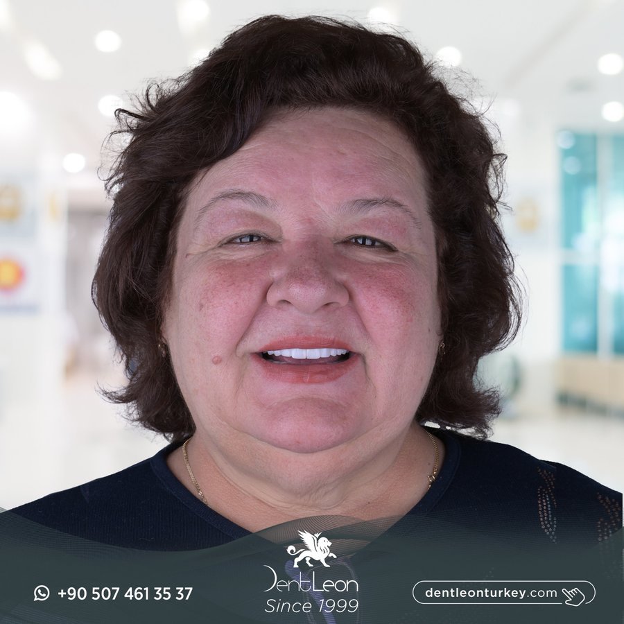 Dent Leon - Dent Leon