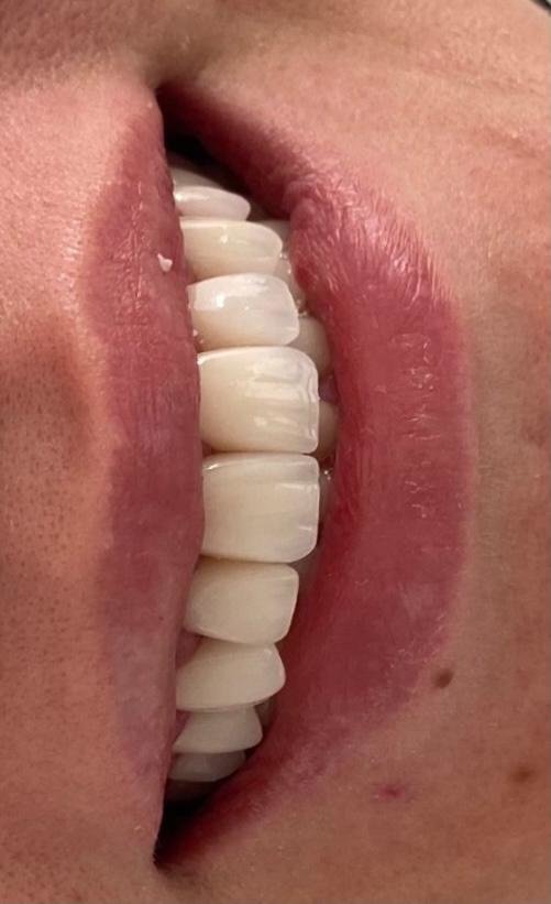 Dent Medica Bodrum - Dr. Kübra Çakır - Dent Medica Bodrum - Dr. Kübra Çakır