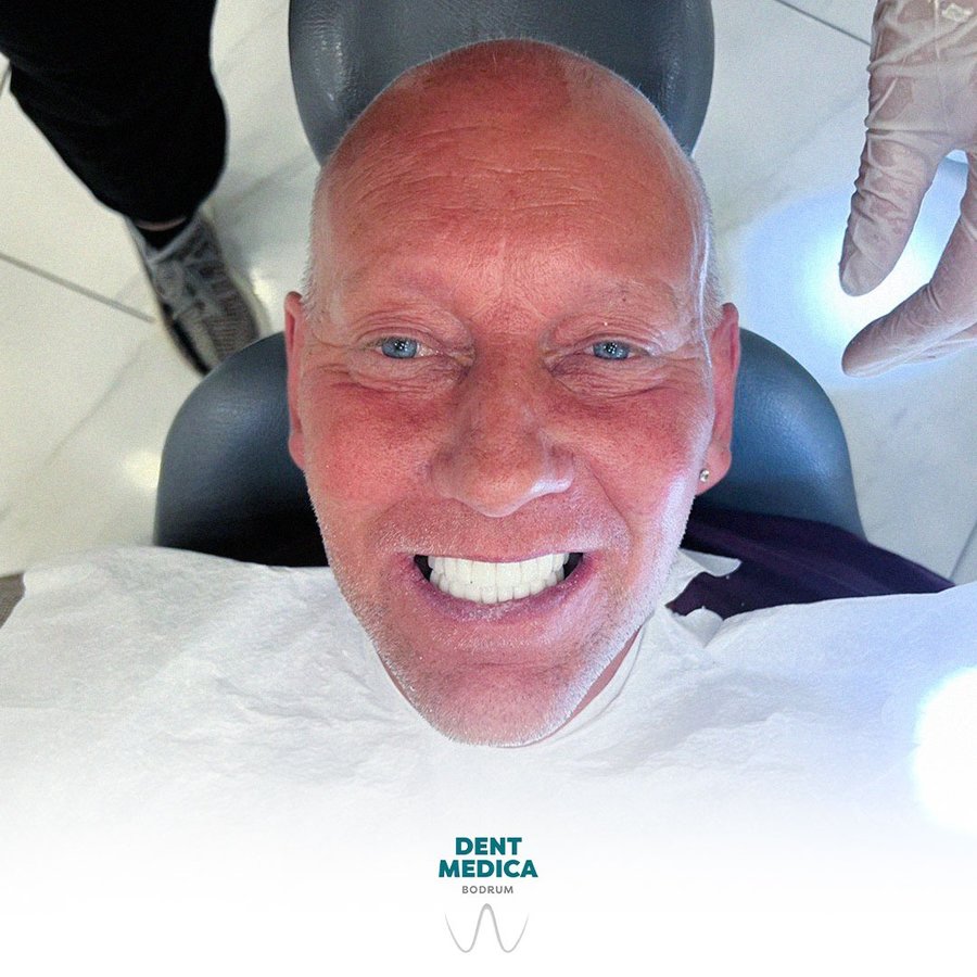 Dent Medica Bodrum - Dr. Kübra Çakır - Dent Medica Bodrum - Dr. Kübra Çakır