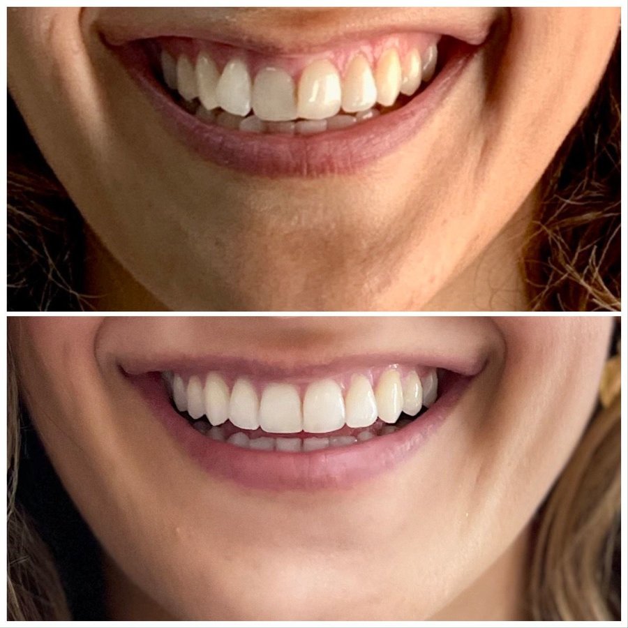 Dent Medica Bodrum - Dr. Kübra Çakır - Dent Medica Bodrum - Dr. Kübra Çakır