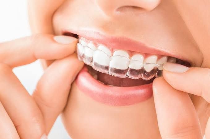 Dent Medica Bodrum - Dr. Kübra Çakır - Dent Medica Bodrum - Dr. Kübra Çakır