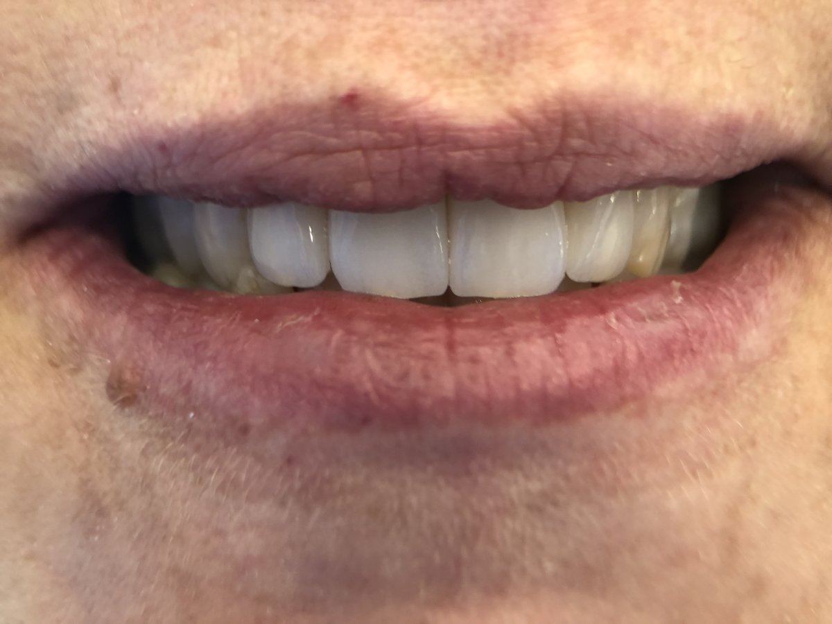 Dent Medica Bodrum - Dr. Kübra Çakır - Dent Medica Bodrum - Dr. Kübra Çakır