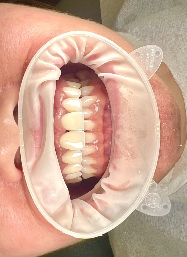 Dent Medica Bodrum - Dr. Kübra Çakır - Dent Medica Bodrum - Dr. Kübra Çakır