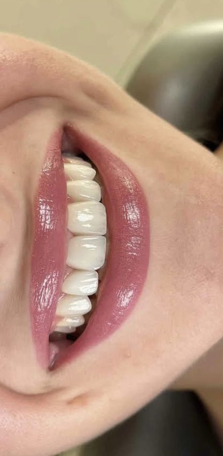 Dent Medica Bodrum - Dr. Kübra Çakır - Dent Medica Bodrum - Dr. Kübra Çakır